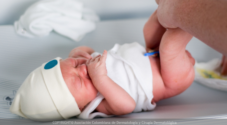 dermatitis de pañal